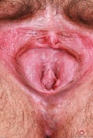 ATK hairy  in young and hairy