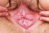 ATK hairy Autumn Berlin Set