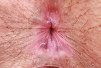 ATK hairy Autumn Berlin Set