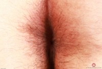 ATK hairy  in young and hairy