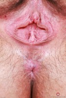 ATK hairy  in young and hairy