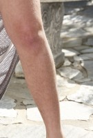 ATK hairy  in young and hairy