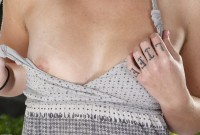 ATK hairy  in young and hairy