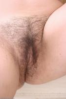 ATK hairy  in mature and hairy