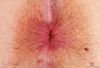 ATK hairy Bella Luna Set