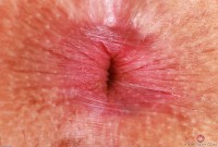 ATK hairy Bella Luna Set