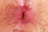 ATK hairy Bella Luna Set