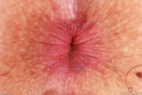 ATK hairy Bella Luna Set