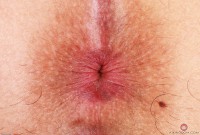 ATK hairy Bella Luna Set