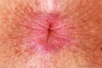 ATK hairy Bella Luna Set