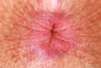 ATK hairy Bella Luna Set