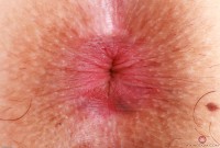 ATK hairy  in exotic and hairy