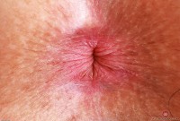 ATK hairy Bella Luna Set