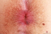 ATK hairy Bella Luna Set