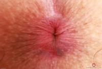 ATK hairy Bella Luna Set