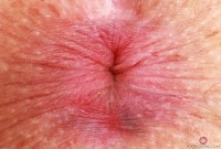 ATK hairy Bella Luna in exotic and hairy