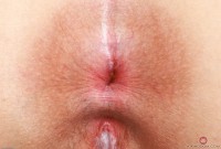 ATK hairy Bess Breast Set