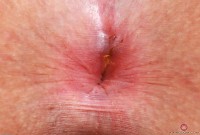 ATK hairy Bess Breast Set