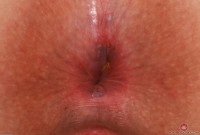 ATK hairy Bess Breast Set