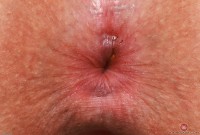 ATK hairy Bess Breast Set