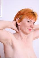 ATK hairy  in mature and hairy