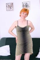 ATK hairy  in mature and hairy