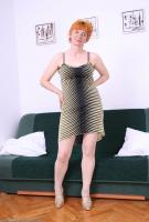 ATK hairy  in mature and hairy