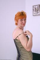 ATK hairy  in mature and hairy