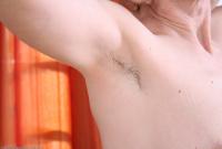 ATK hairy  in mature and hairy