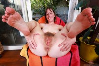 ATK hairy  in young and hairy