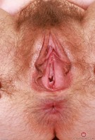 ATK hairy  in young and hairy