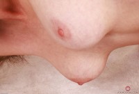 ATK hairy  in young and hairy