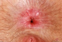 ATK hairy Big Eyes Set