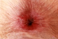 ATK hairy Big Eyes Set