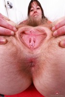 ATK hairy  in young and hairy