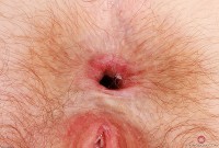 ATK hairy  in young and hairy