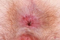 ATK hairy Big Eyes Set