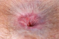 ATK hairy  in hairy fun