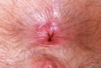 ATK hairy  in young and hairy