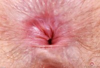 ATK hairy Big Eyes Set