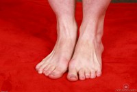 ATK hairy  in young and hairy