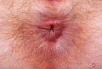 ATK hairy Big Eyes in young and hairy