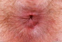 ATK hairy Big Eyes Set