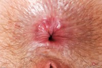 ATK hairy Big Eyes Set