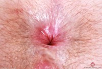 ATK hairy Big Eyes Set