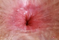 ATK hairy Big Eyes Set