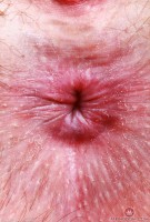 ATK hairy Big Eyes Set