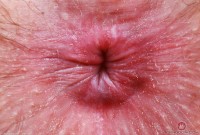 ATK hairy Big Eyes Set