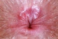 ATK hairy Big Eyes Set