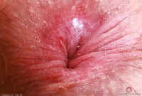 ATK hairy Big Eyes Set